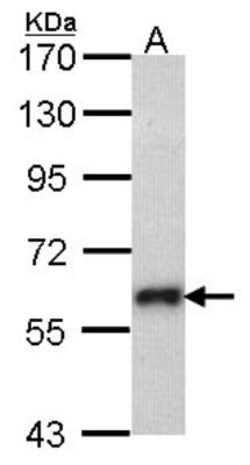 SOCS-5 Antibody, Novus Biologicals 0.1mg; Unlabeled:Antibodies, Polyclonal