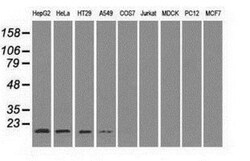 SOD1/Cu-Zn SOD Antibody (OTI8B10), Novus Biologicals 0.1mL; Unlabeled:Antibodies,