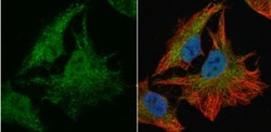 SOD1/Cu-Zn SOD Antibody, Novus Biologicals 0.1mg; Unlabeled:Antibodies,