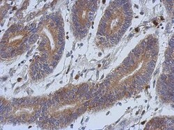 SOD1/Cu-Zn SOD Antibody, Novus Biologicals 0.1mg; Unlabeled:Antibodies,