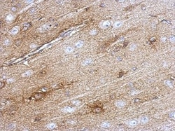 SOD1/Cu-Zn SOD Antibody, Novus Biologicals 0.1mg; Unlabeled:Antibodies,