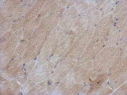 SOD1/Cu-Zn SOD Antibody, Novus Biologicals 0.1mg; Unlabeled:Antibodies,