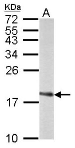 SOD1/Cu-Zn SOD Antibody, Novus Biologicals 0.1mg; Unlabeled:Antibodies,