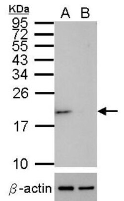 SOD1/Cu-Zn SOD Antibody, Novus Biologicals 0.1mg; Unlabeled:Antibodies,