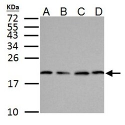 SOD1/Cu-Zn SOD Antibody, Novus Biologicals 0.1mg; Unlabeled:Antibodies,