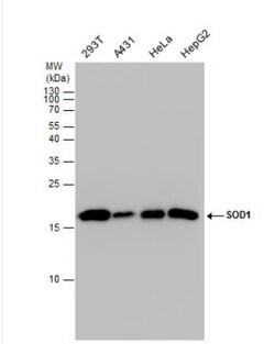 SOD1/Cu-Zn SOD Antibody, Novus Biologicals 0.1mg; Unlabeled:Antibodies,