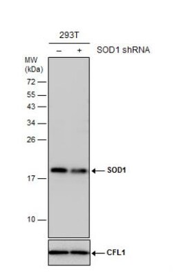 SOD1/Cu-Zn SOD Antibody, Novus Biologicals 0.1mg; Unlabeled:Antibodies,