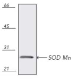SOD2/Mn-SOD Antibody, Novus Biologicals:Antibodies:Primary Antibodies