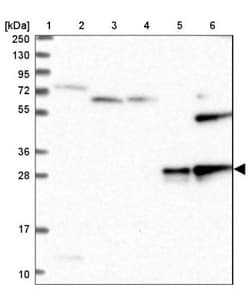 SOD3/EC-SOD Antibody, Novus Biologicals 0.1mL; Unlabeled:Antibodies, Polyclonal