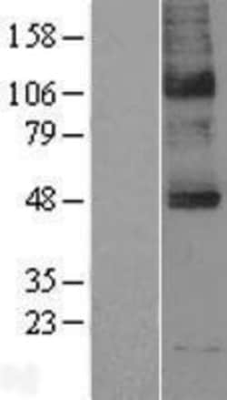 Novus Biologicals&trade;&nbsp;SLC5A5/Sodium Iodide Symporter Overexpression Lysate