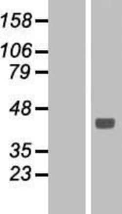 Novus Biologicals™ Sodium Potassium ATPase Beta 1 Overexpression Lysate