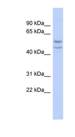 SOHLH2 Antibody, Novus Biologicals 100 &mu;L | Buy Online | Novus Biologicals | Fisher Scientific