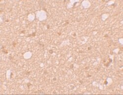 Solo Antibody - BSA Free, Novus Biologicals 0.1mg; Unlabeled:Antibodies,