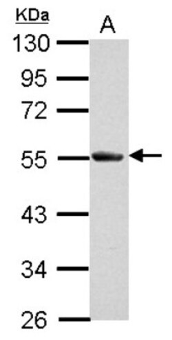 Soluble Liver/Pancreas Antigen Antibody, Novus Biologicals 0.1mL; Unlabeled:Antibodies,