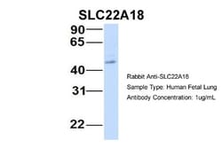 Solute carrier family 22 member 18 Antibody, Novus Biologicals:Antibodies:Primary