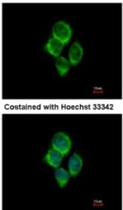 solute carrier family 22, member 18 antisense Antibody, Novus Biologicals