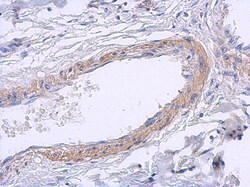 solute carrier family 22, member 18 antisense Antibody, Novus Biologicals