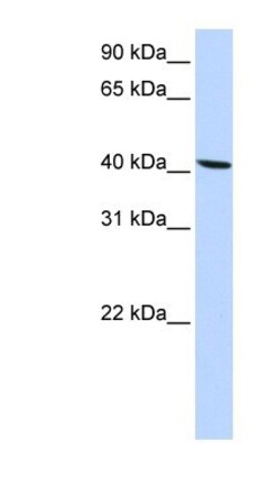 Solute carrier family 22 member 18 Antibody, Novus Biologicals:Antibodies:Primary