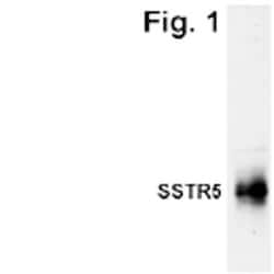 Somatostatin R5/SSTR5 Antibody, Novus Biologicals 0.025 mL, Unconjugated:Antibodies,