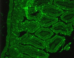 Somatostatin R2/SSTR2 Antibody, Novus Biologicals 0.1mL; Unlabeled:Antibodies,