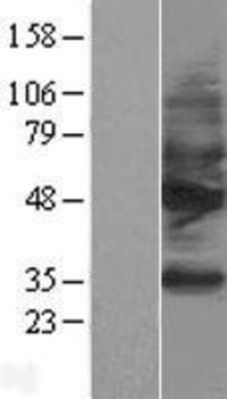 Novus Biologicals&trade;&nbsp;Somatostatin R2/SSTR2 Overexpression Lysate