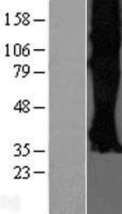 Novus Biologicals&trade;&nbsp;Somatostatin R3/SSTR3 Overexpression Lysate