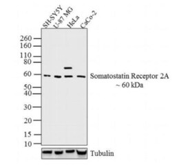 Somatostatin R2/SSTR2 Antibody, Novus Biologicals 0.025 mL | Buy Online | Novus Biologicals | Fisher Scientific