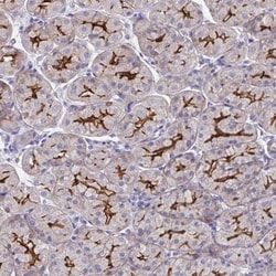 Somatostatin R1/SSTR1 Antibody, Novus Biologicals:Antibodies:Primary Antibodies