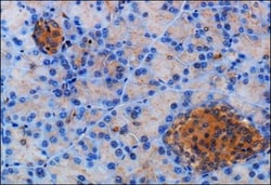 Somatostatin R2/SSTR2 Antibody, Novus Biologicals 0.1mL; Unlabeled:Antibodies,