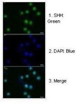 Sonic Hedgehog/Shh Antibody, Novus Biologicals 0.05mg; Unlabeled:Antibodies,