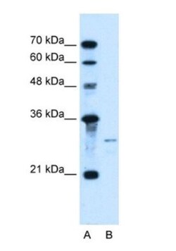 Sonic Hedgehog/Shh Antibody, Novus Biologicals 0.05mg; Unlabeled:Antibodies,