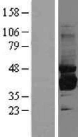 Novus Biologicals™ Sorbitol Dehydrogenase Overexpression Lysate