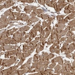 SORBS1 Antibody, Novus Biologicals:Antibodies:Primary Antibodies