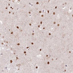 SORBS2 Antibody, Novus Biologicals:Antibodies:Primary Antibodies