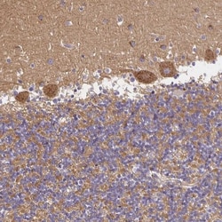 SorLA Antibody, Novus Biologicals 25 &mu;L, Unlabeled:Antibodies, Polyclonal