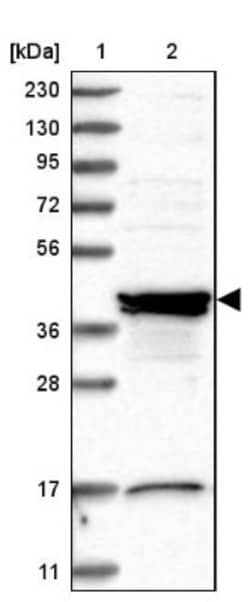 Sorting Nexin 31 Antibody, Novus Biologicals 0.1mL; Unlabeled:Antibodies,