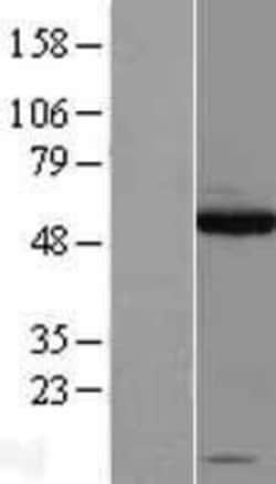 Novus Biologicals™ SOX10 Overexpression Lysate