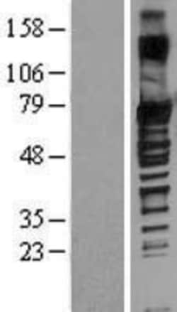 Novus Biologicals™ SOX13 Overexpression Lysate