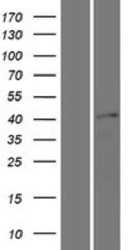 Novus Biologicals&trade;&nbsp;SOX17 Overexpression Lysate