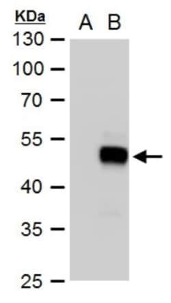 SOX18 Antibody, Novus Biologicals 0.1mL:Antibodies, Polyclonal