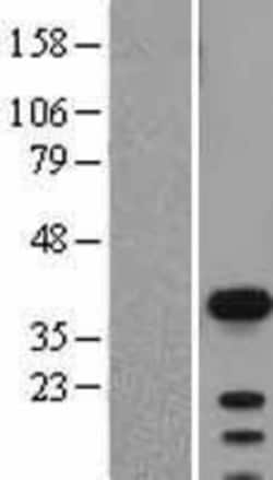 Novus Biologicals&trade;&nbsp;SOX2 Overexpression Lysate