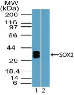 SOX2 Antibody, Novus Biologicals 0.025mg; Unlabeled:Antibodies, Polyclonal