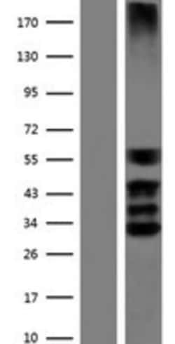 Novus Biologicals&trade;&nbsp;SOX3 Overexpression Lysate