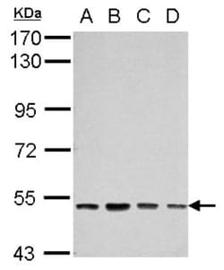 SOX30 Antibody, Novus Biologicals 0.1mL; Unlabeled:Antibodies, Polyclonal