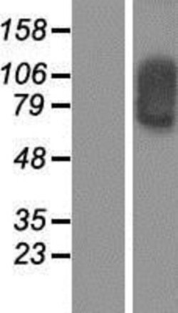 Novus Biologicals&trade;&nbsp;SOX30 Overexpression Lysate
