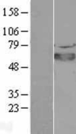 Novus Biologicals&trade;&nbsp;SOX4 Overexpression Lysate