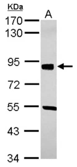 SOX6 Antibody, Novus Biologicals 0.1 mL | Buy Online | Novus Biologicals | Fisher Scientific