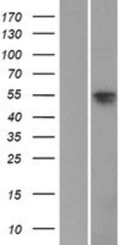 Novus Biologicals™ SOX8 Overexpression Lysate