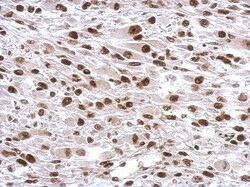 SP1 Antibody, Novus Biologicals 0.1mL; Unlabeled:Antibodies, Polyclonal