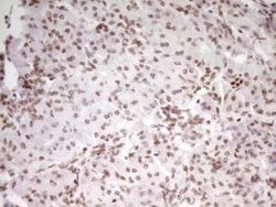SP110 Antibody (OTI4C1), Novus Biologicals 0.1mL; Unlabeled:Antibodies,